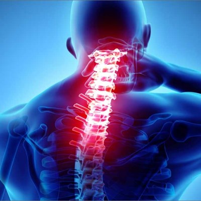 نکات قابل توجه در بیماران گردن درد